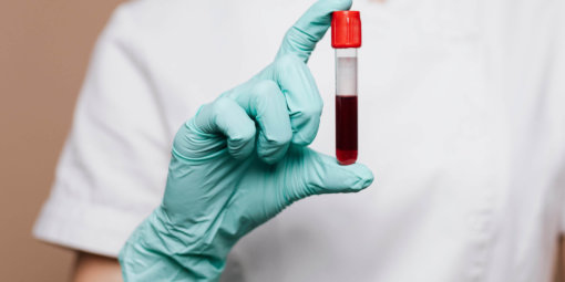 Nurse holding a blood test tube